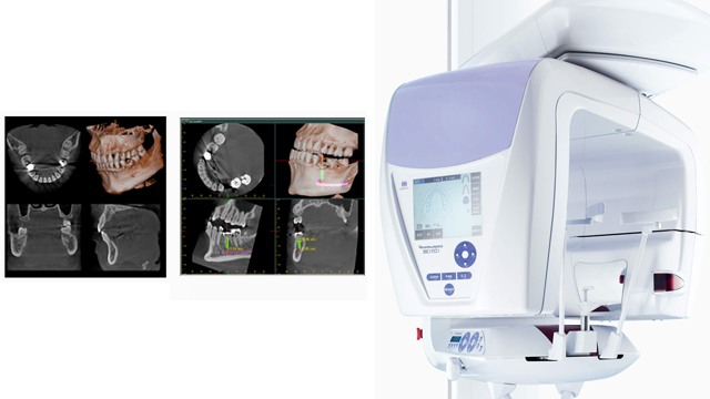 歯科用CT（3D撮影）・セファロ完備