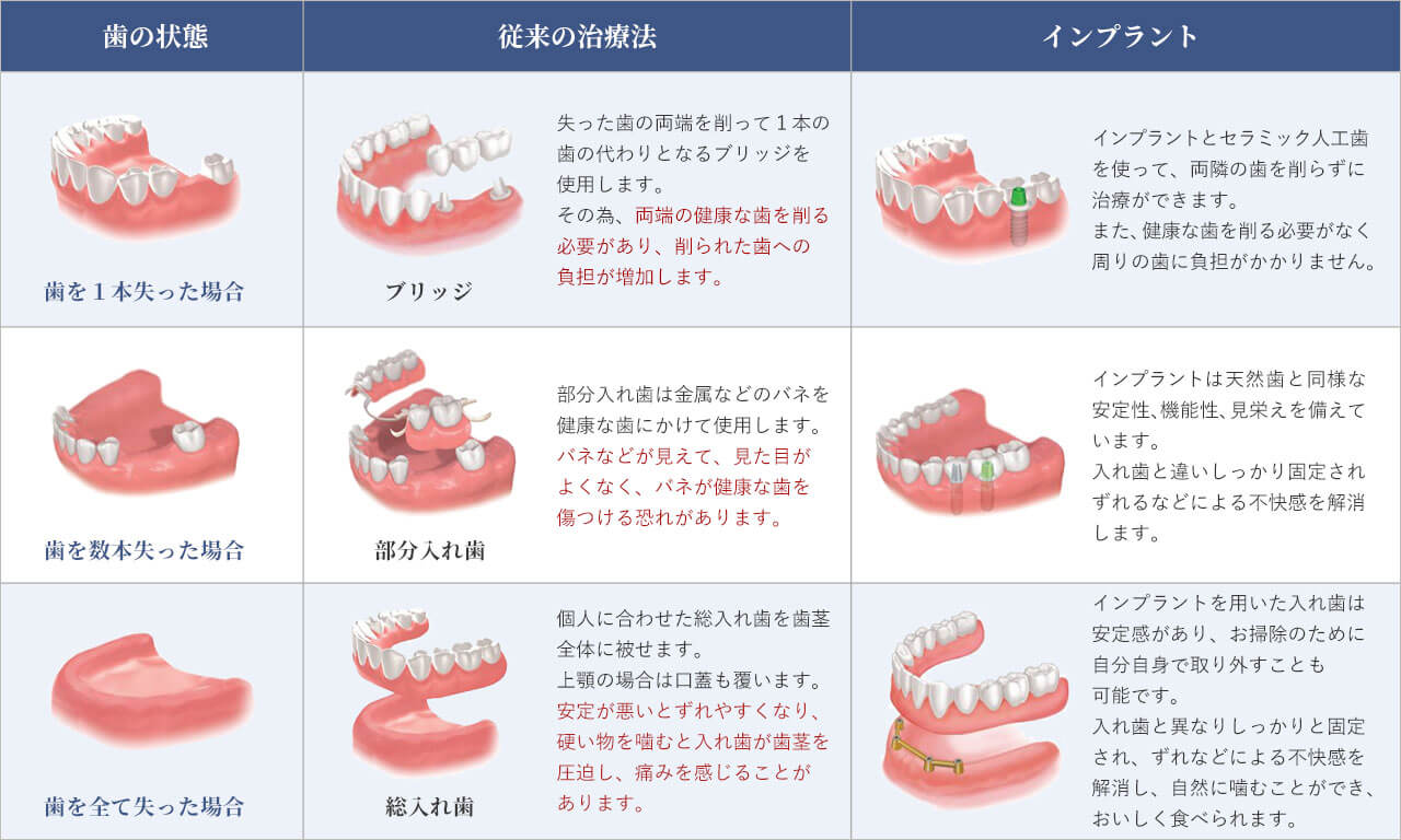 インプラントと他の治療法との比較