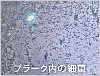 プラークの細菌